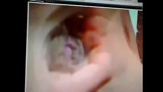 Penis